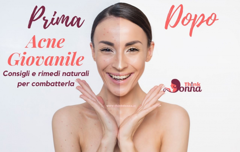 viso donna giovane problemi acne prima e dopo sorriso 