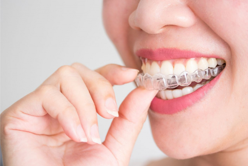 cure odontoiatra denti sani apparecchi dentali per adulti invisibili.