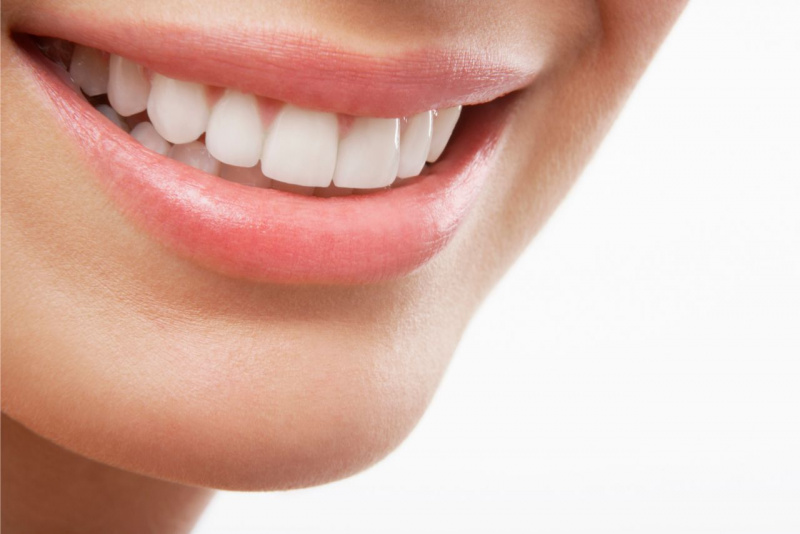 denti bianchi allineati labbra rosa sorriso femminile