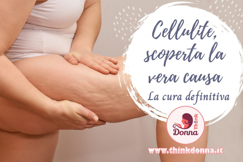 donna in sovrappeso controlla cellulite gamba 