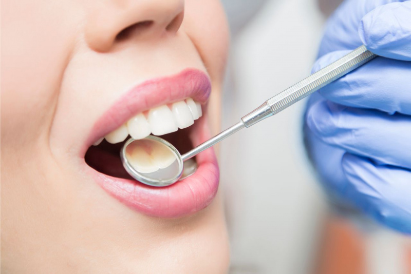dental checkup cura dentista controllo denti sani
