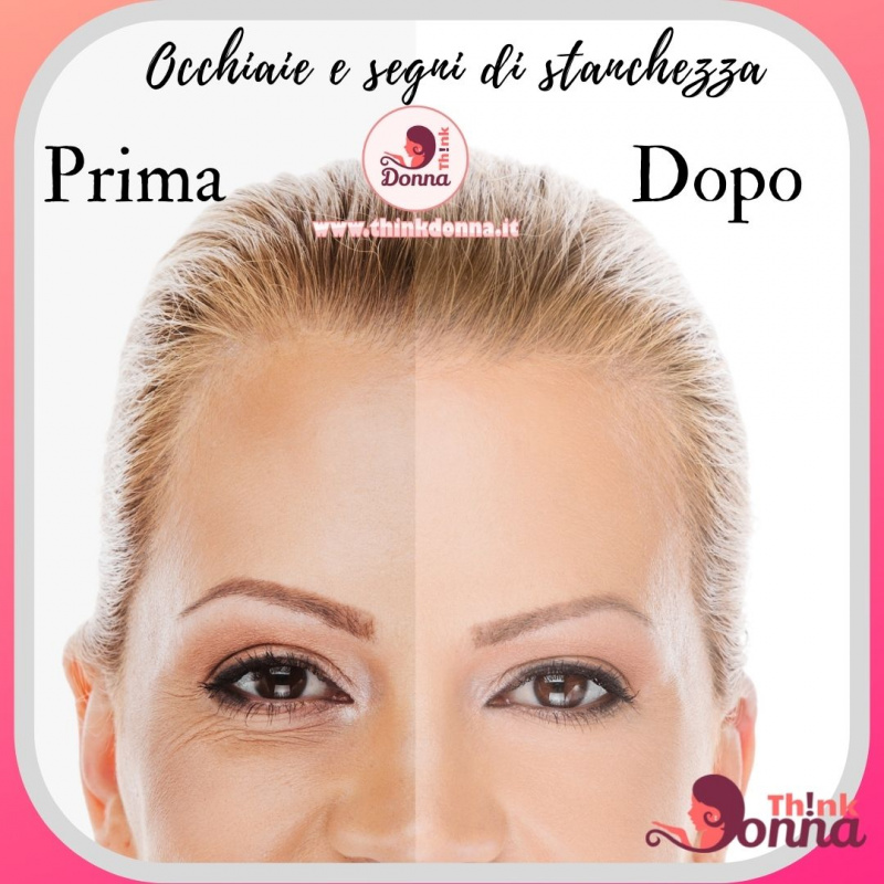 prima e dopo occhiaie trucco coprente viso donna