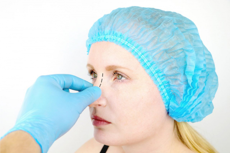 mano con guanto chirurgico dottore controlla naso donna prima intervento rinoplastica cuffia