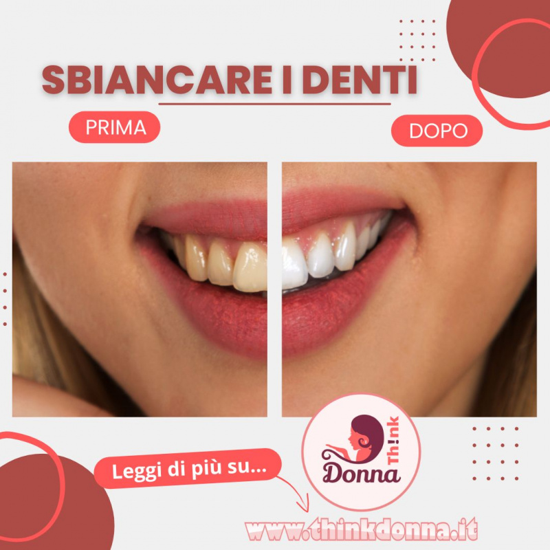 denti donna prima gialli poi bianchi sbiancamento