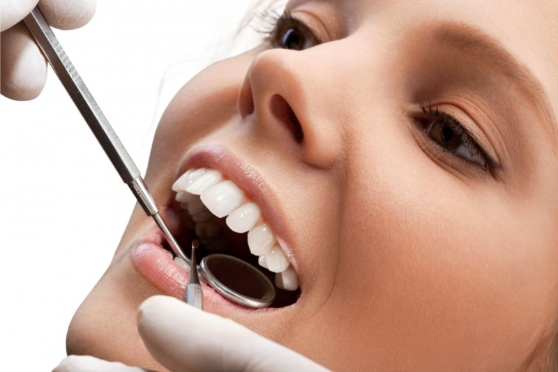 visita controllo dentista denti bianchi 